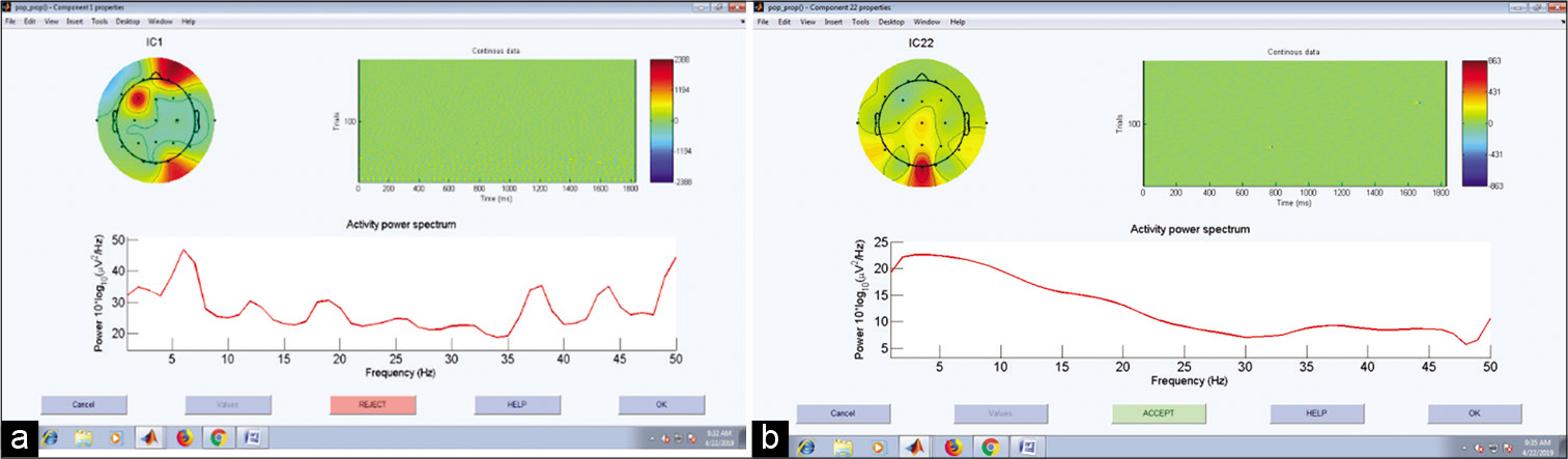 Scalp map with (a) and without (b) eye blink artifact.